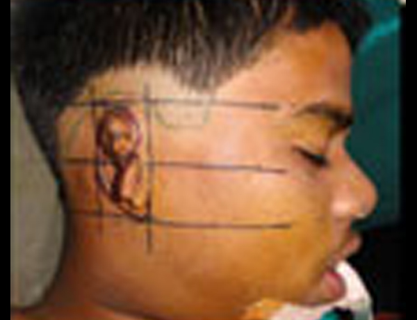 Marking