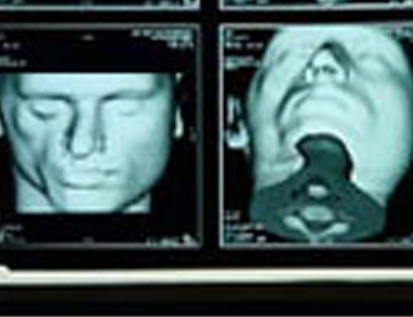 3D CT-Scan of Soft Tissue