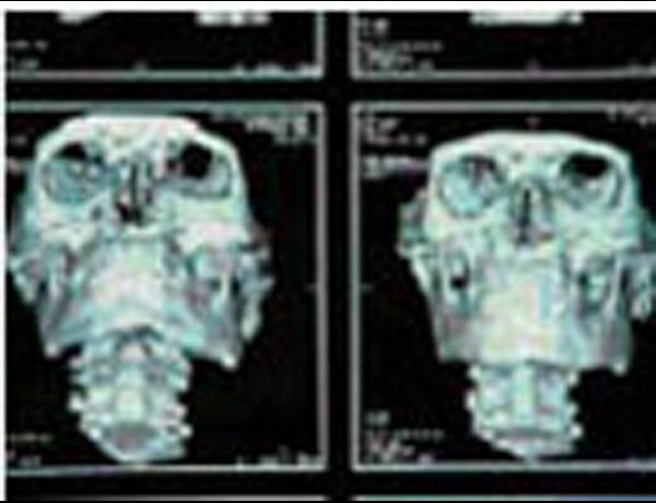 3D CT-Scan of Skeleton