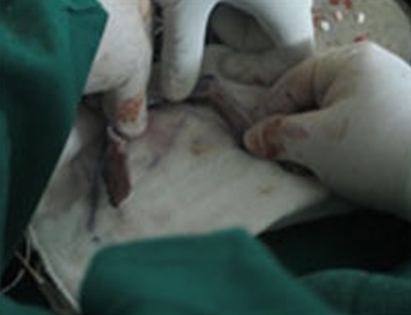 Manipulation of Bone
