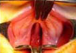 Type III b Isolated Cleft of Hard and Soft Palate